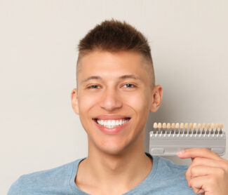 Dental Veneers