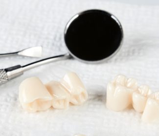 How Dental Crowns Help Prevent Cracks from Turning Into Tooth Loss